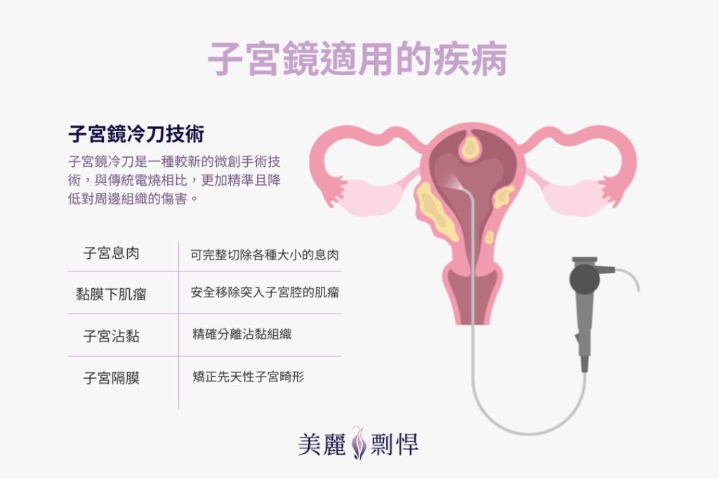 子宮鏡冷刀技術
